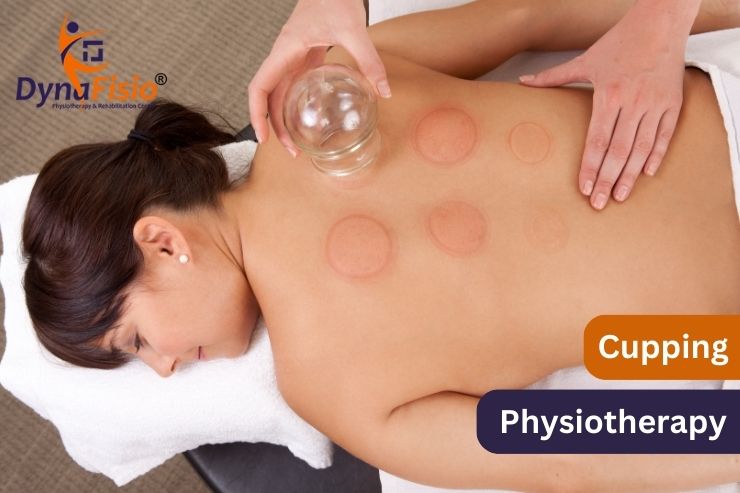 Revitalize Your Body and Mind with Cupping Therapy in Gurgaon