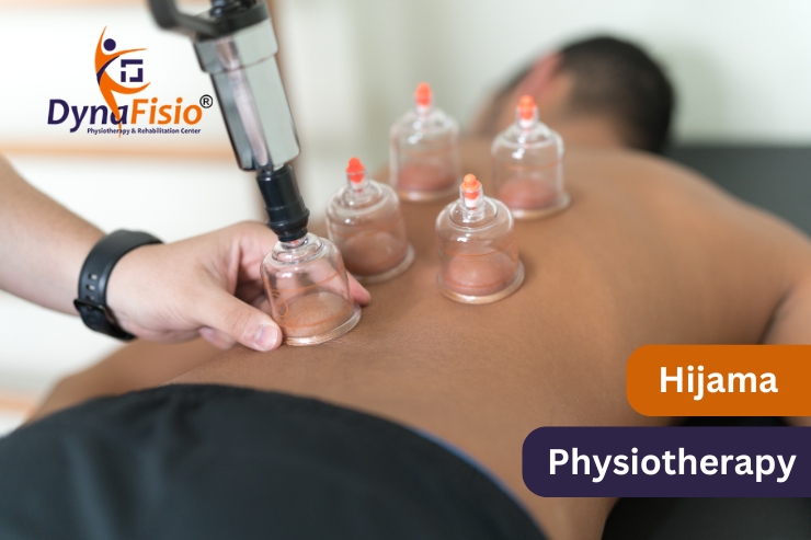 Why Hijama Therapy is Gaining Popularity as a Treatment for Back Pain