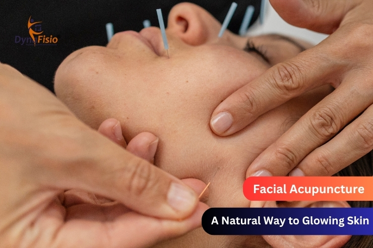 Facial Acupuncture in Gurgaon: A Natural Way to Glowing Skin