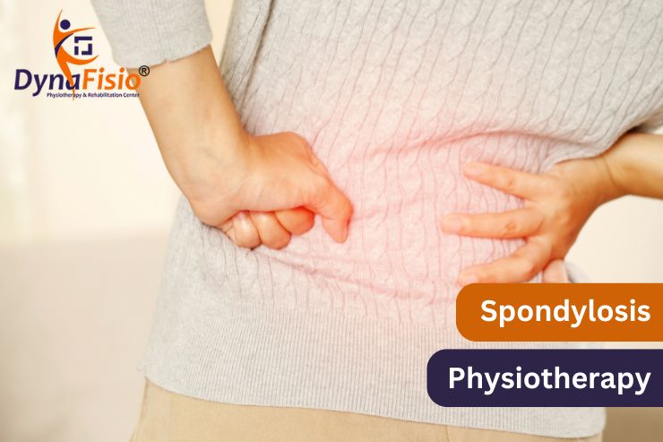 Beyond Medication: Exploring Physiotherapy as a Key Treatment for Spondylosis