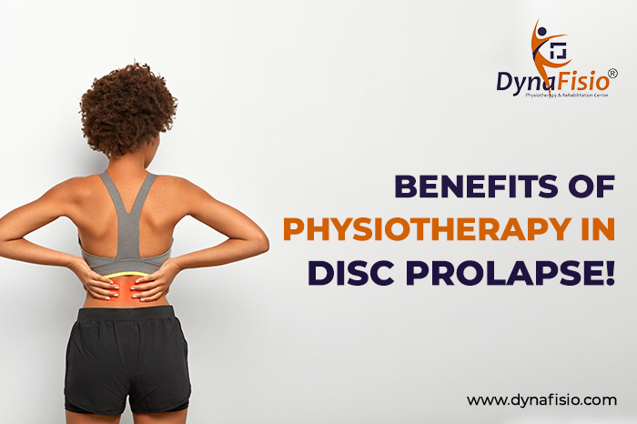 Benefits of physiotherapy in disc prolapse