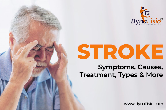 Stroke: Symptoms, Causes, Treatment, Types & More