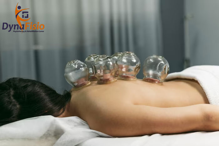 Cupping Therapy: What Is It and How Does It Work?
