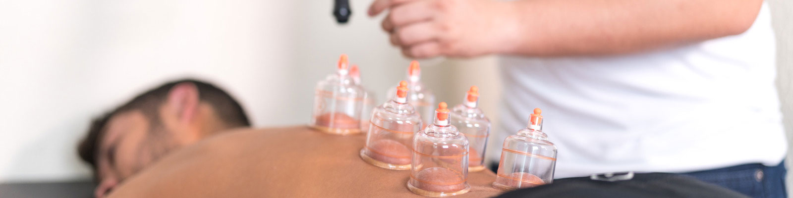 Cupping Therapy Treatment in Gurgaon