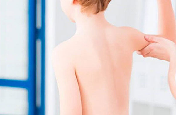 Muscular Dystrophy Physiotherapy Treatment in Gurgaon