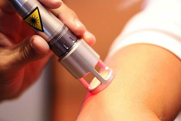 Laser Therapy Treatment in Gurgaon