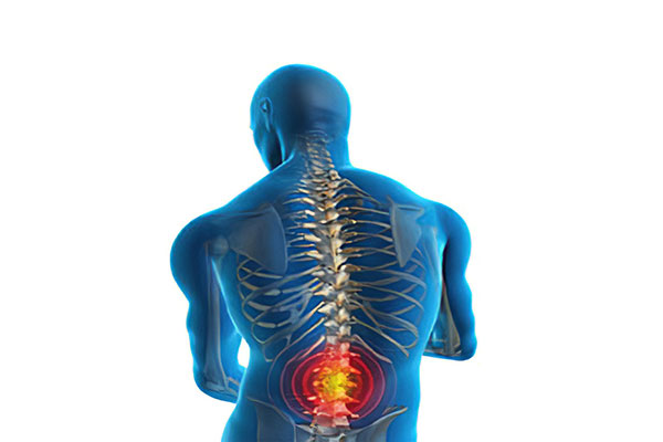 Spondylosis Physiotherapy Treatment in Gurgaon